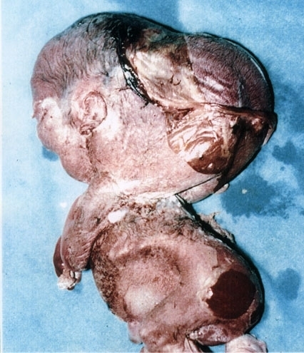 Depleted Uranium for...